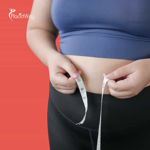 Why Thousands of United Kingdom Patients are Trading NHS Waiting Lists for Gastric Sleeve Packages in Turkey This Year